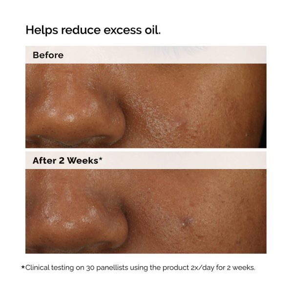 Balancing & Clarifying Serum for Blemish-Prone Skin Online now